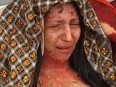 Femei chinuite:ingropate de vii, arse cu acid si mutilate in zona genitala!