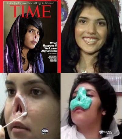 Adolescenta afgana mutilata de catre sotul ei pentru ca a incercat sa paraseasca casa socrilor, si-a recapatat zambetul - FOTO