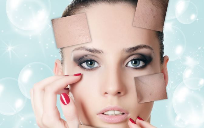 Ce iti spun cosurile tale? Descopera ce probleme de sanatate ai in functie de zona fetei afectata de acnee Ce iti spun cosurile tale? Descopera ce probleme de sanatate ai in functie de zona fetei afectata de acnee