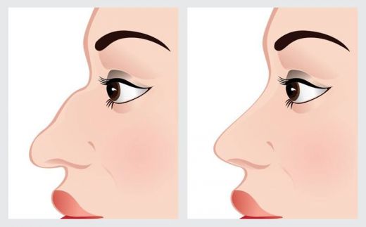 Ce spune nasul despre tine? La ce trebuie sa fii atenta cand te uiti la nasul cuiva