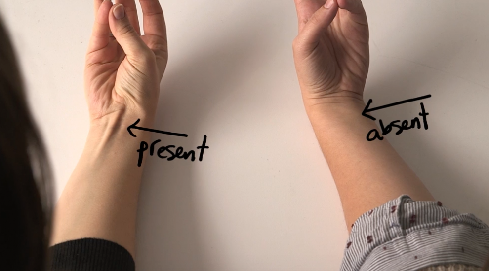 La unii oameni se vede, la altii nu. Ce inseamna cand tendonul de pe mana e mai proeminent