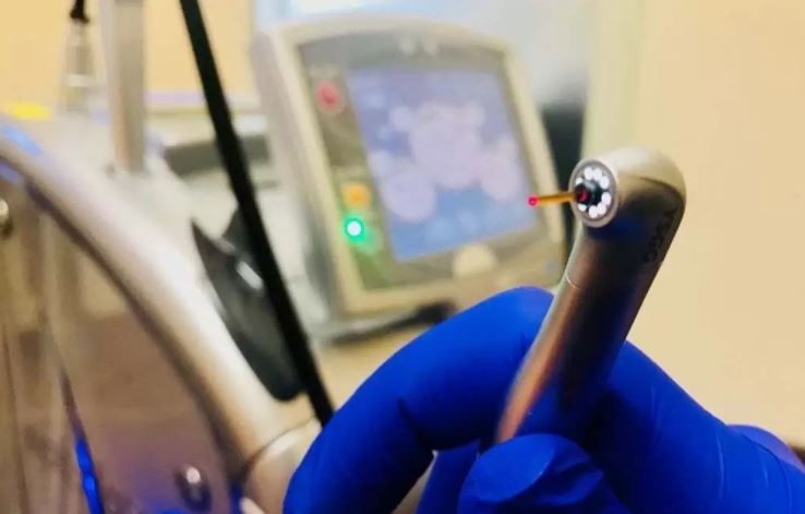 (P) Care sunt avantajele laserului dentar? (P) Care sunt avantajele laserului dentar?