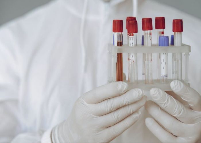 (P) Analize și investigații medicale pe care ar fi bine să ți le faci anual