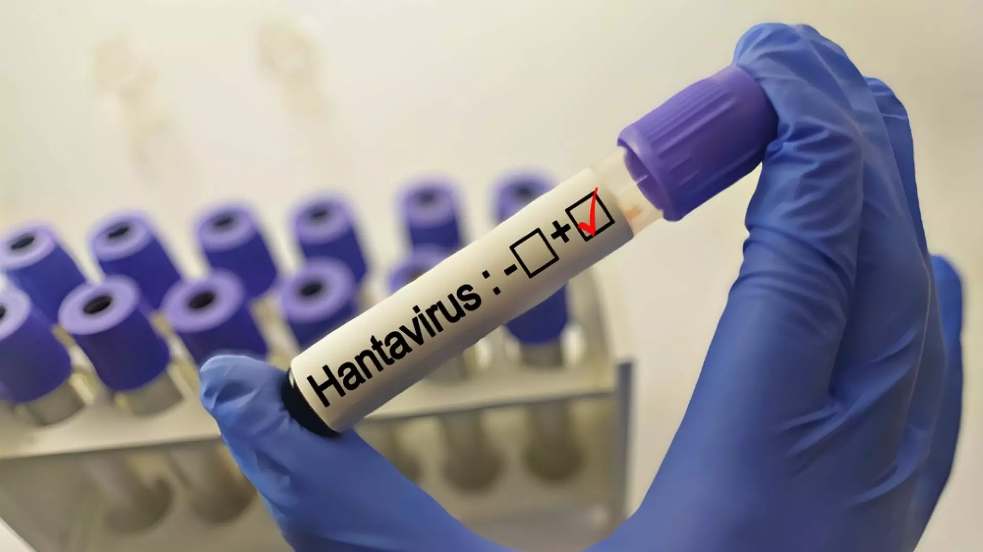 Surse: Un nou caz de hantavirus în România. Nu ar fi o variantă transmisibilă de la om la om