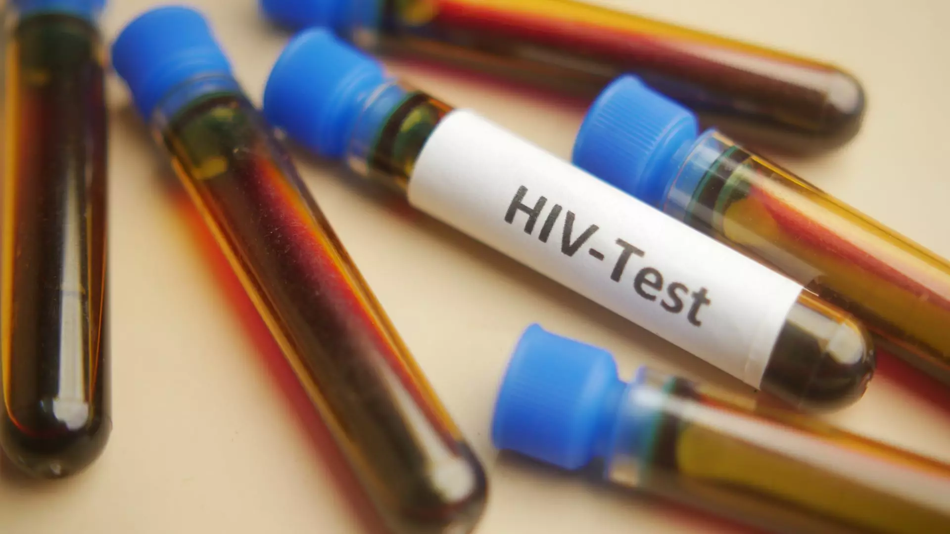 O țară cu mai puțini locuitori decât Bucureștiul a declarat alertă națională de HIV. 1 din 60 de adulți trăiește cu virusul