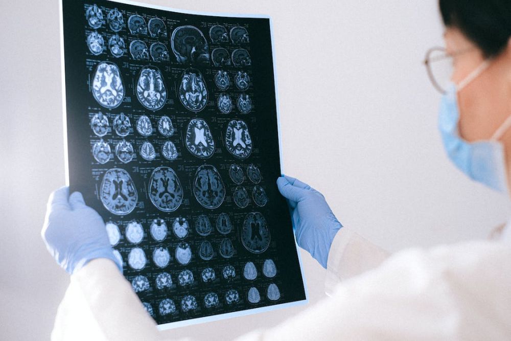 Implant cerebral pentru a trata depresia și paralizia. Proiectul SF devenit realitate