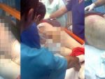 Ministrul Sanatatii publica IMAGINI SOCANTE cu o pacienta cu rani pe corp CA SA JUSTIFICE INCHIDEREA SPITALELOR