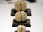 Un european din trei sufera de afectiuni neurologice