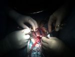 Ministrul Sanatatii promite sa caute bani pentru reluarea transplantului de cord din semestrul II