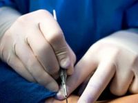 Bisturiul inteligent, care identifica tesutul canceros