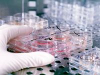 Test revolutionar, capabil sa estimeze numarul de ani pe care ii mai are o persoana de trait