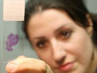 Test de depistare a cancerului ovarian, dezvoltat de americani. Poate descoperi tumorile in stadiul lor incipient