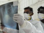 Cel putin 1.000 de cazuri de gripa cu virus A H1N1 si cinci morti in Canada