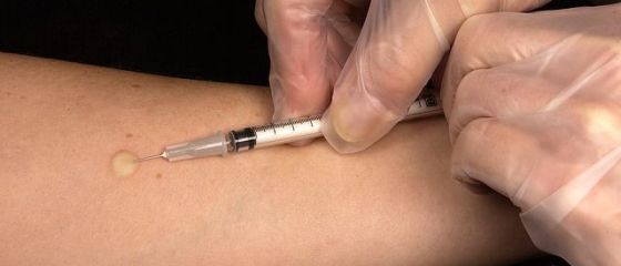 O treime din bugetul alocat sanatatii se cheltuieste numai pe internari. 300 de diagnostice dispar din lista bolilor care se trateaza in spital