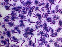 Aproximativ 75 de cercetatori americani ar fi fost expusi bacteriei antraxului