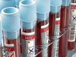 Un britanic ar putea fi prima persoana din lume vindecata de virusul HIV