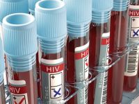 Un britanic ar putea fi prima persoana din lume vindecata de virusul HIV