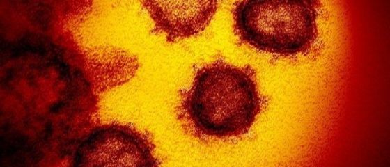 Un nou prag psihologic atins de pandemie. Peste 8 milioane de oameni infectați cu coronvirus, la nivel global