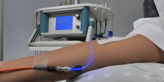 (P) Poate ajuta terapia cu laser intravenos în afecțiuni autoimune sau infecții cronice?